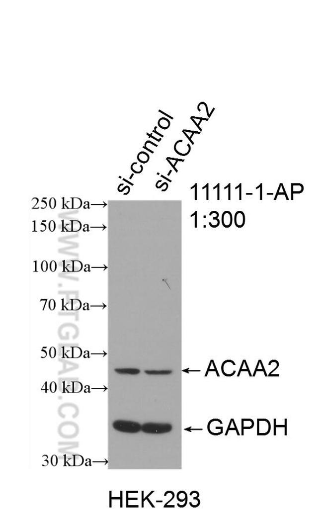 ACAA2 Antibody in Western Blot (WB)