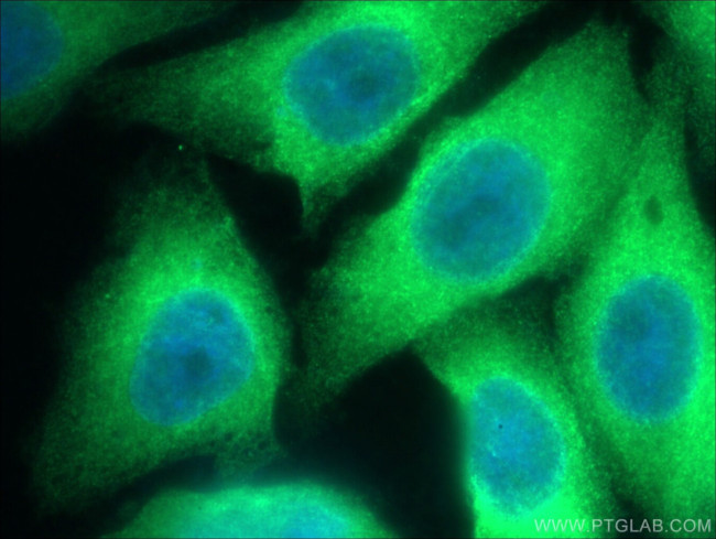 TAP1 Antibody in Immunocytochemistry (ICC/IF)