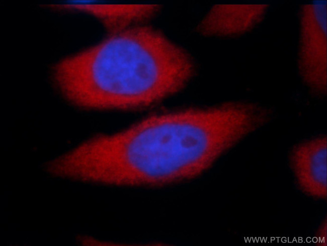 TAP1 Antibody in Immunohistochemistry (Paraffin) (IHC (P))