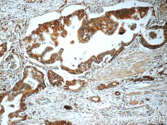 TAP1 Antibody in Immunohistochemistry (Paraffin) (IHC (P))