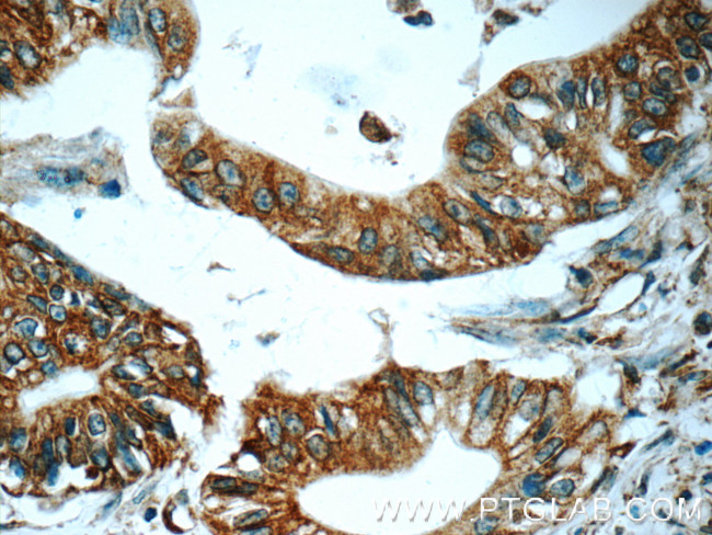 TAP1 Antibody in Immunohistochemistry (Paraffin) (IHC (P))