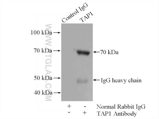 TAP1 Antibody in Immunoprecipitation (IP)