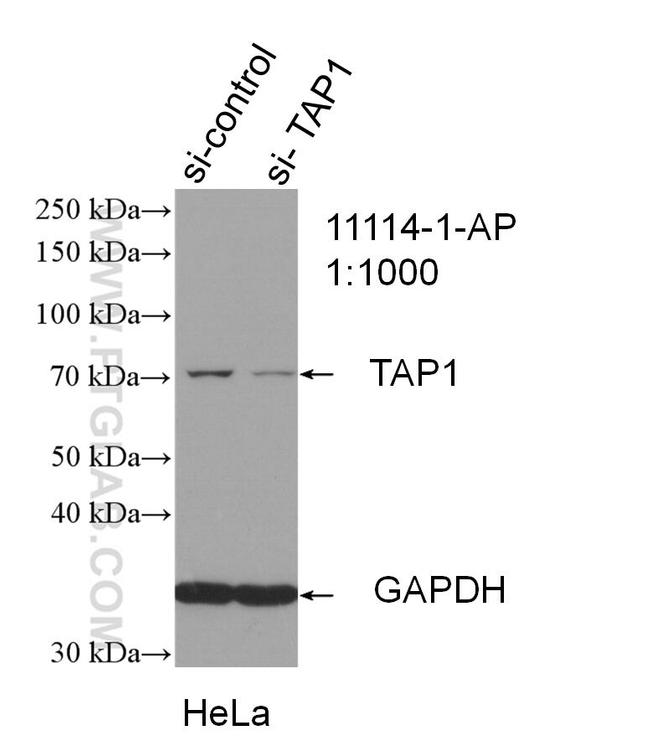 TAP1 Antibody in Western Blot (WB)