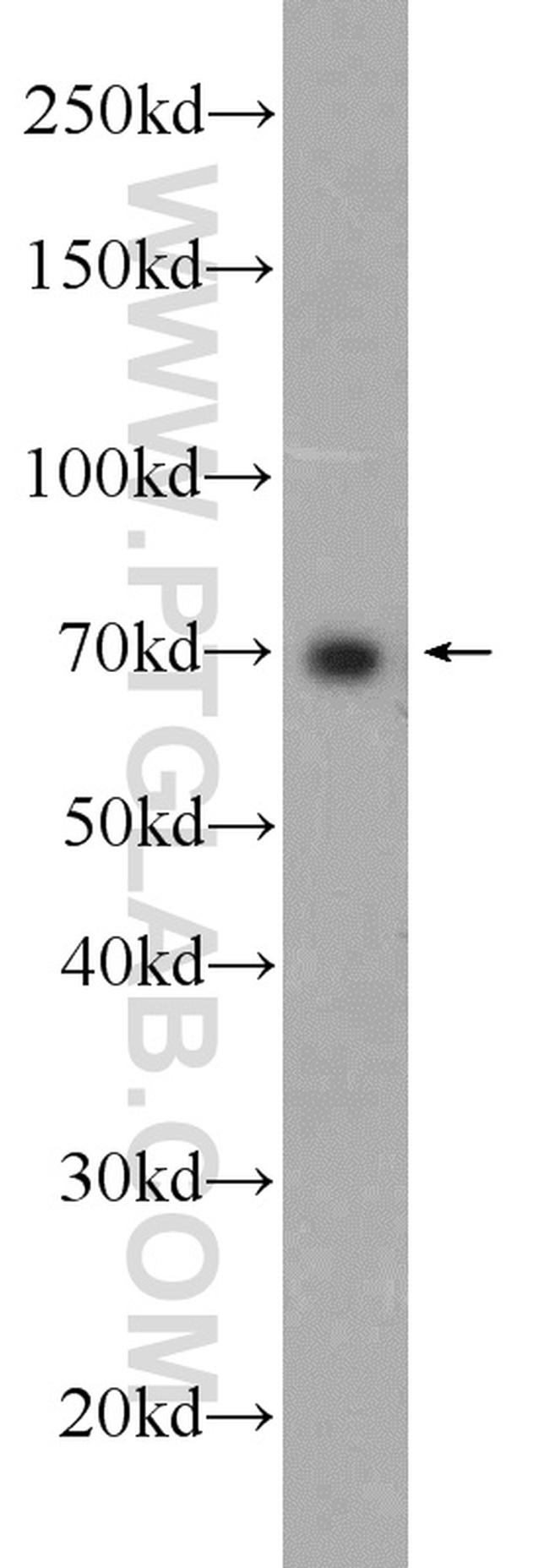 TAP1 Antibody in Western Blot (WB)