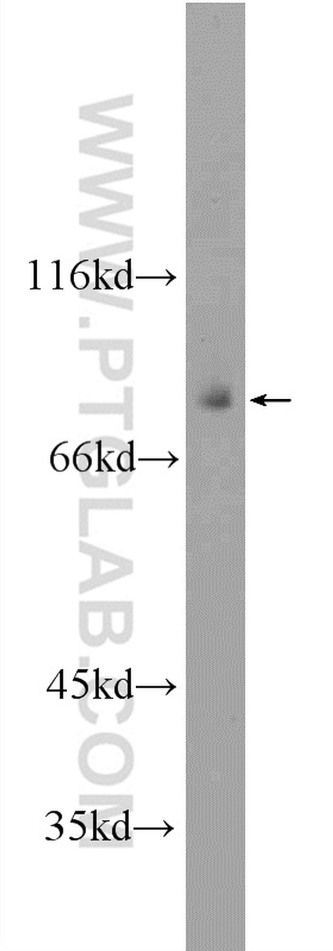 TAP1 Antibody in Western Blot (WB)