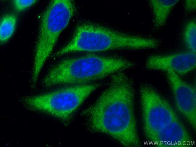 DDX3 Antibody in Immunocytochemistry (ICC/IF)