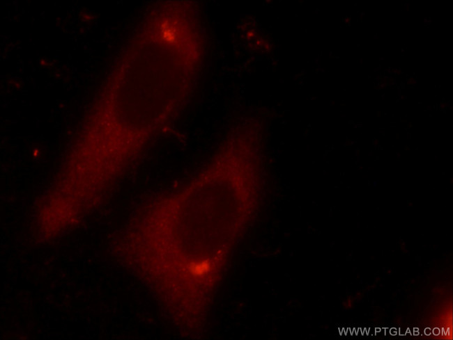 DDX3 Antibody in Immunocytochemistry (ICC/IF)