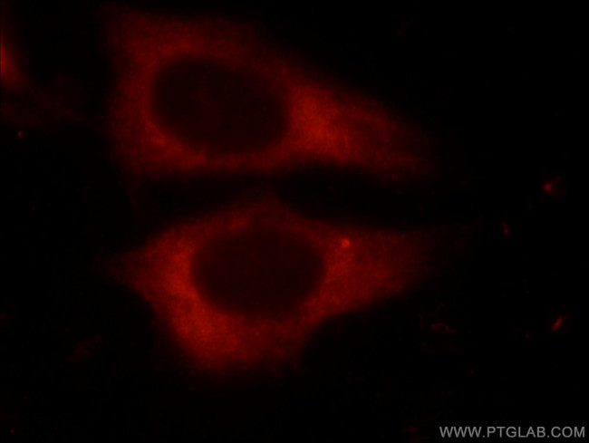 DDX3 Antibody in Immunocytochemistry (ICC/IF)