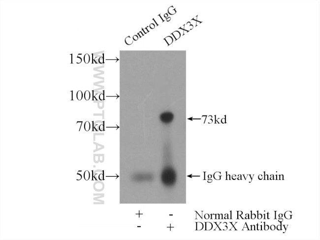 DDX3 Antibody in Immunoprecipitation (IP)