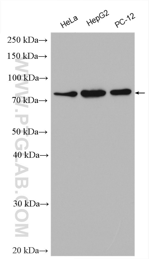 DDX3 Antibody in Western Blot (WB)