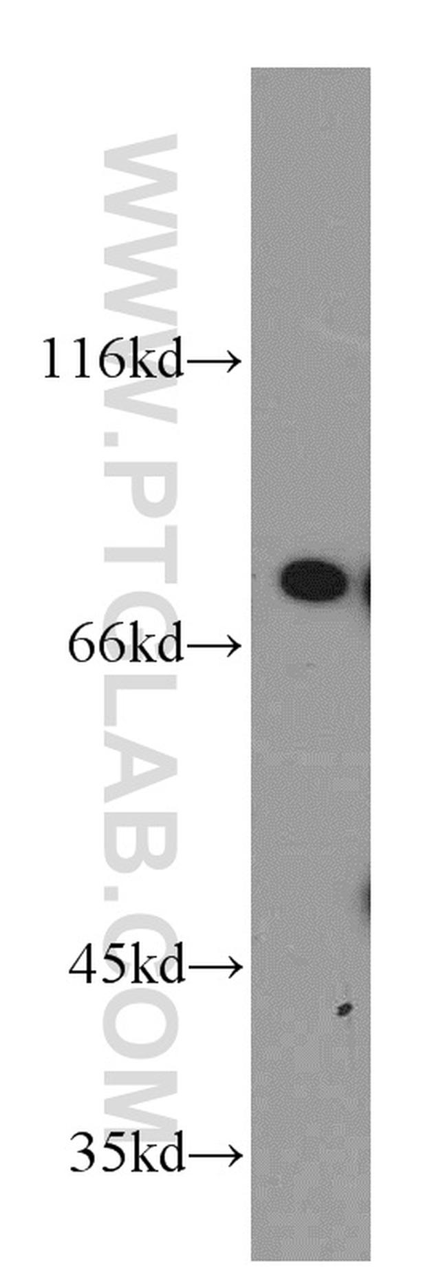 DDX3 Antibody in Western Blot (WB)