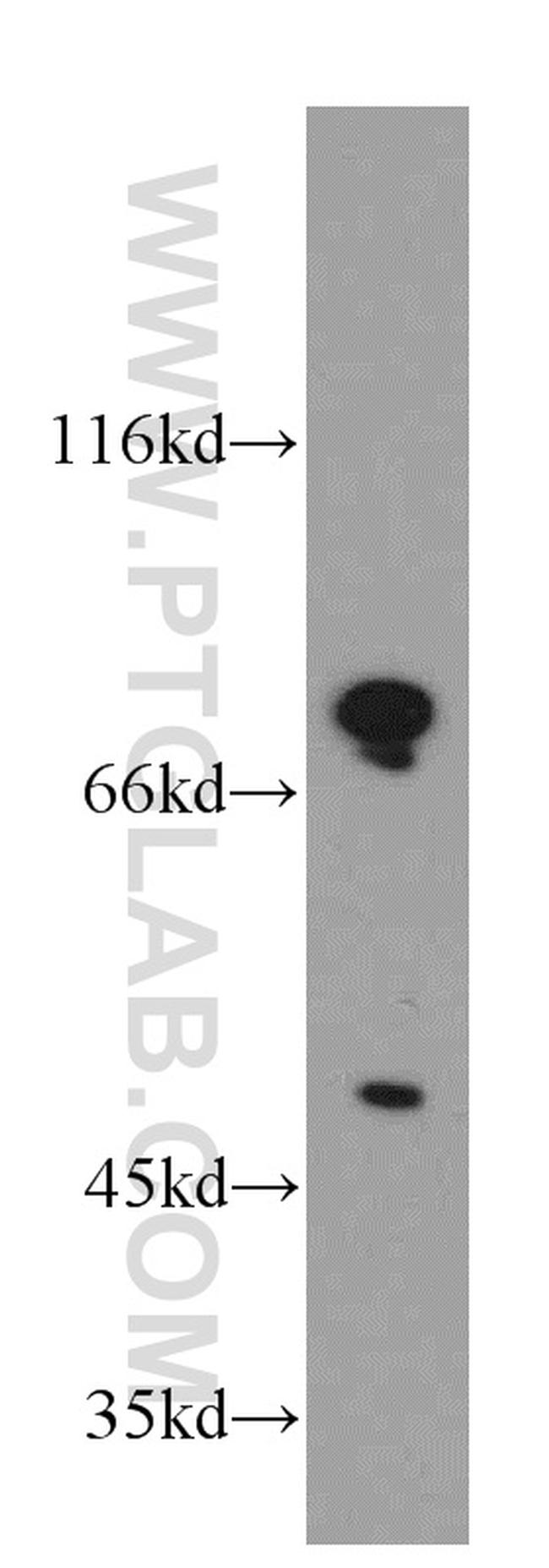 DDX3 Antibody in Western Blot (WB)