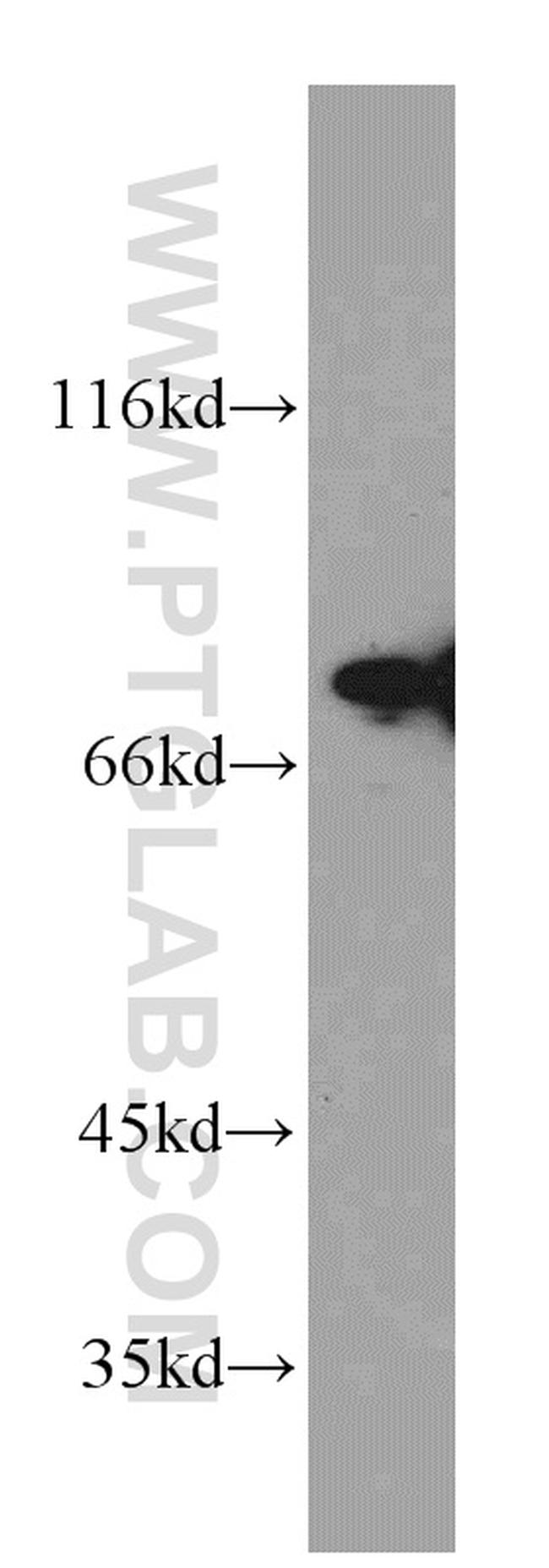 DDX3 Antibody in Western Blot (WB)