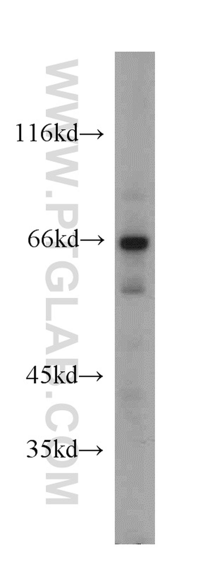 DDX3 Antibody in Western Blot (WB)