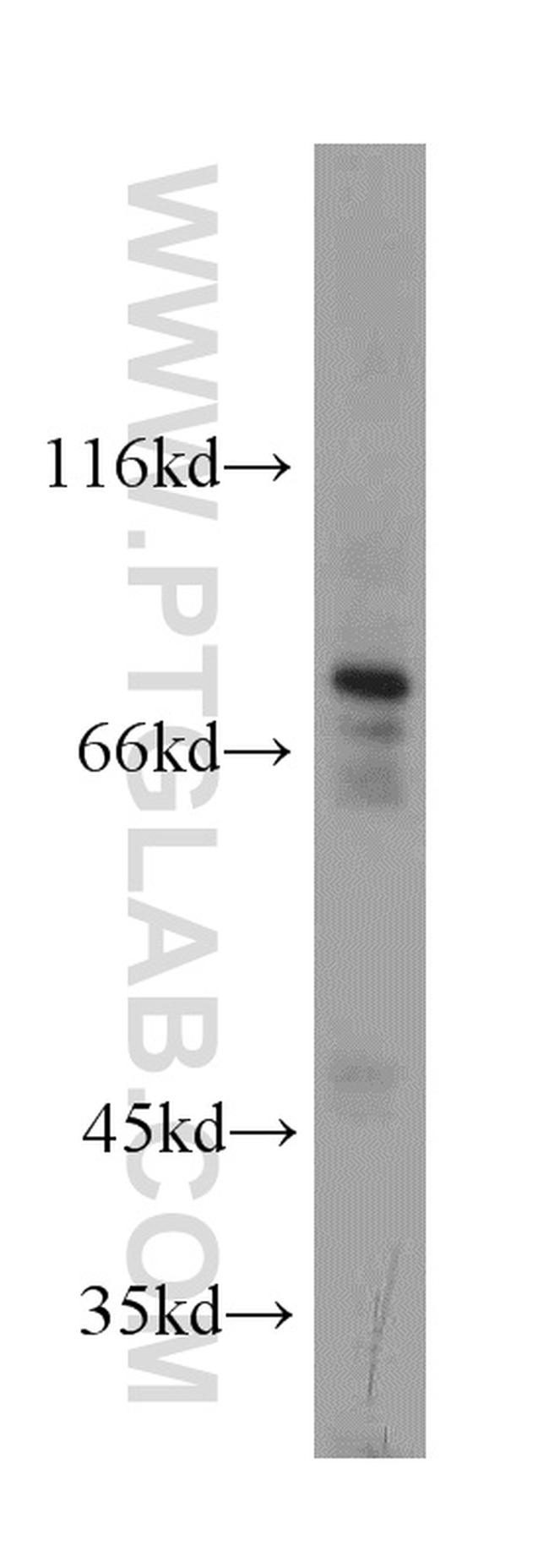 DDX3 Antibody in Western Blot (WB)