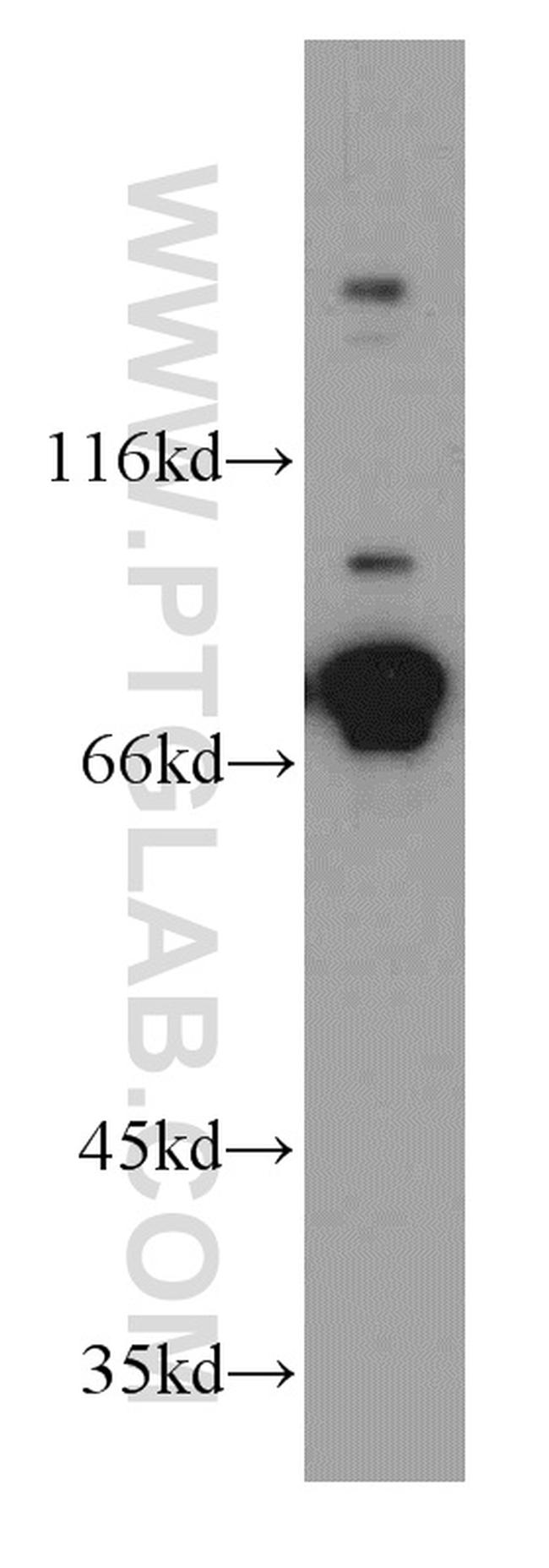 DDX3 Antibody in Western Blot (WB)