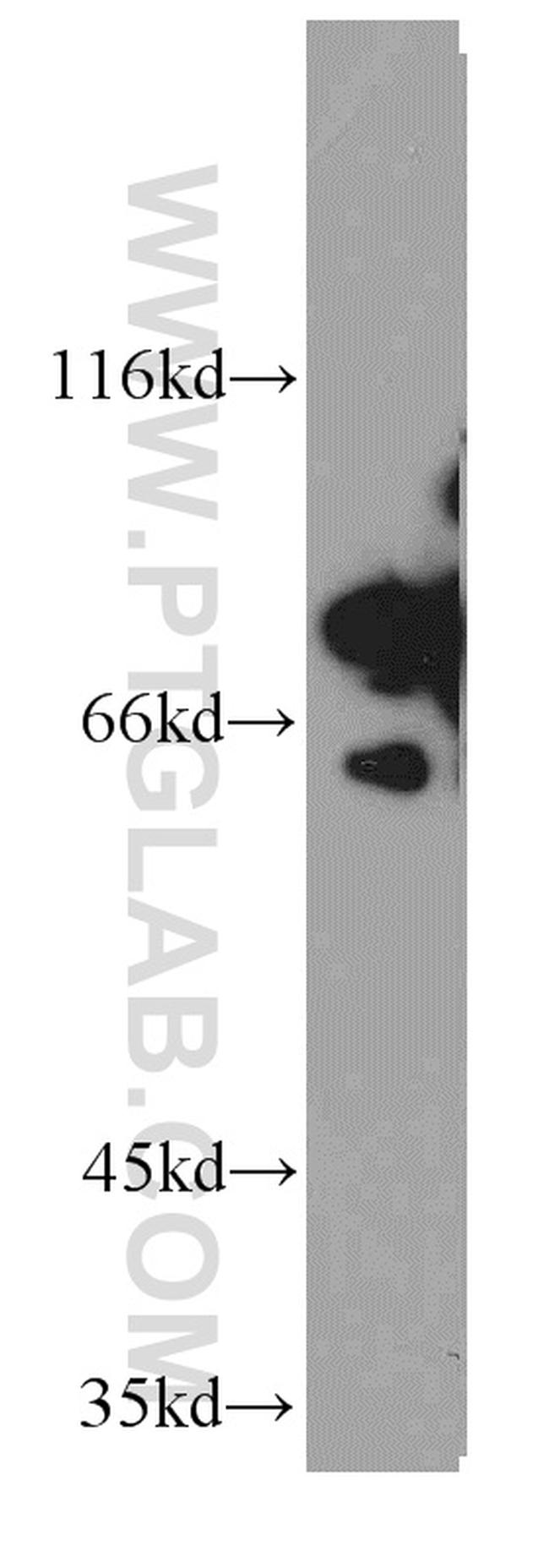 DDX3 Antibody in Western Blot (WB)