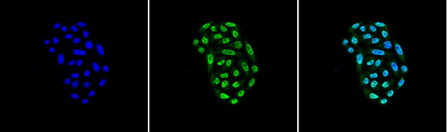 Hsp70 Antibody in Immunocytochemistry (ICC/IF)