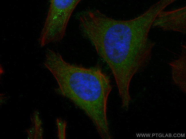 TXNRD1 Antibody in Immunocytochemistry (ICC/IF)