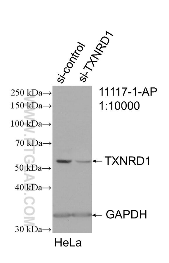 TXNRD1 Antibody in Western Blot (WB)