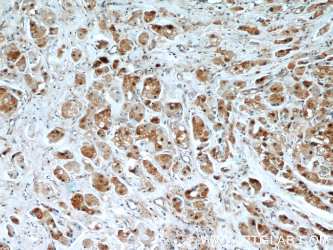 TXNRD1 Antibody in Immunohistochemistry (Paraffin) (IHC (P))