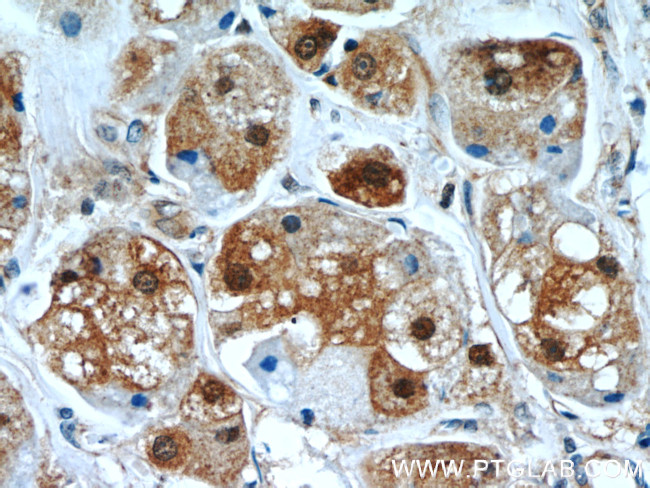 TXNRD1 Antibody in Immunohistochemistry (Paraffin) (IHC (P))