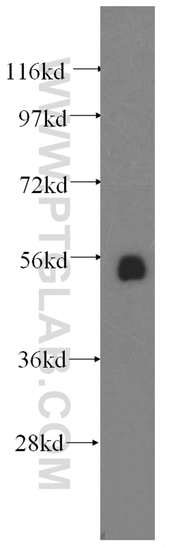 TXNRD1 Antibody in Western Blot (WB)