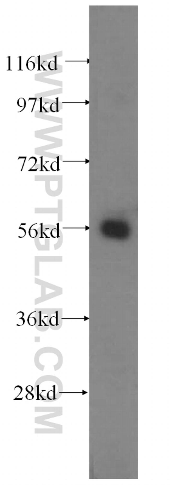 TXNRD1 Antibody in Western Blot (WB)