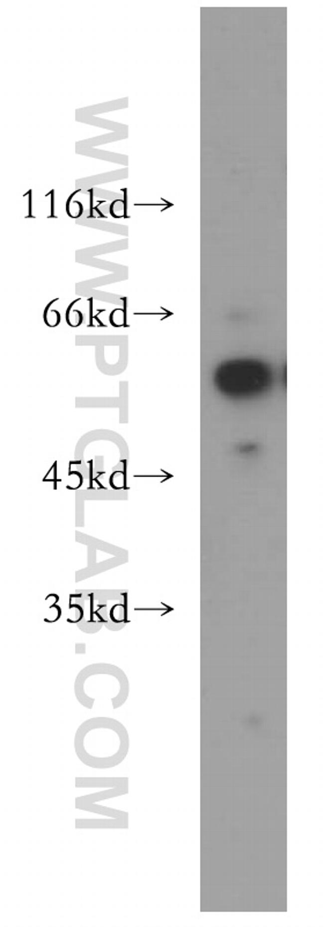 TXNRD1 Antibody in Western Blot (WB)