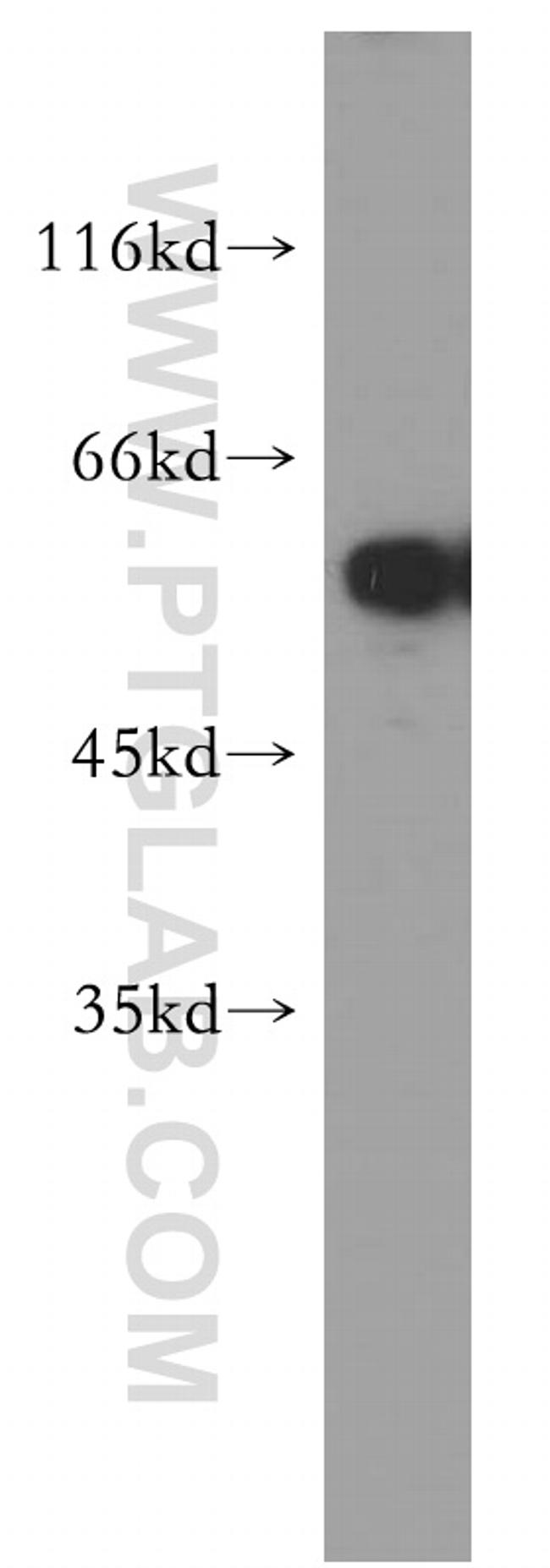 TXNRD1 Antibody in Western Blot (WB)