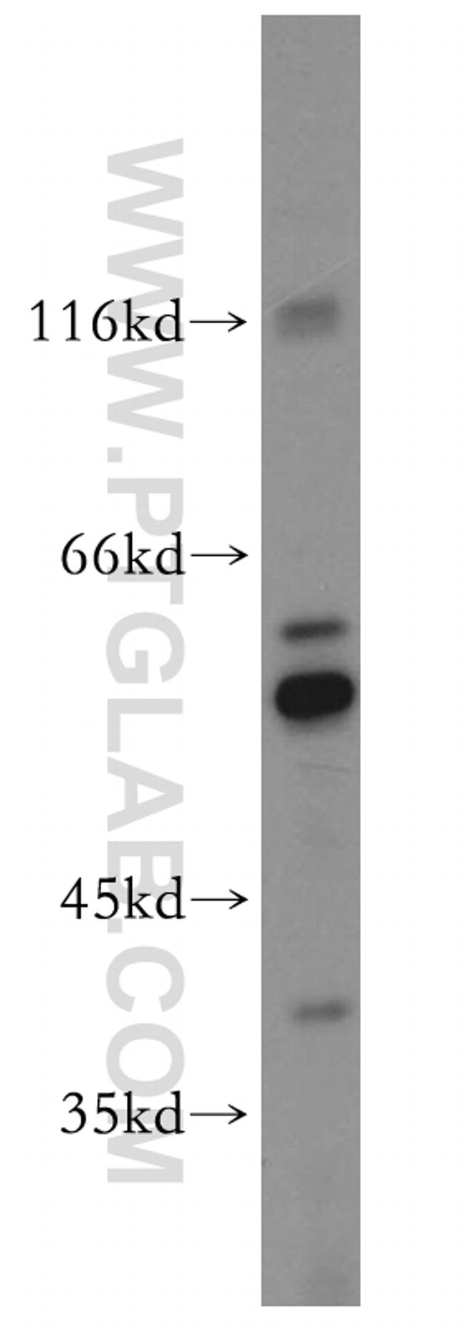 TXNRD1 Antibody in Western Blot (WB)