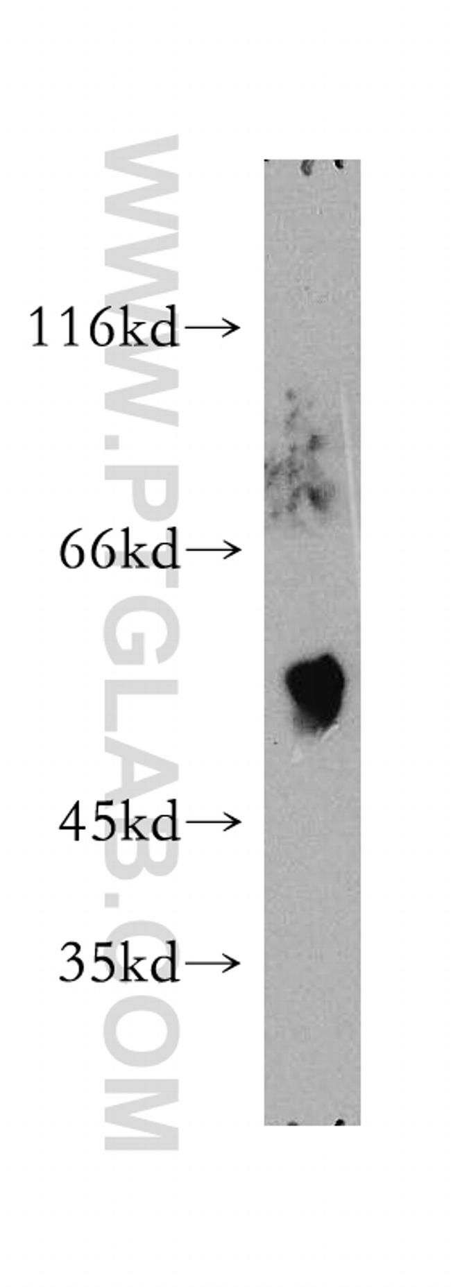 TXNRD1 Antibody in Western Blot (WB)