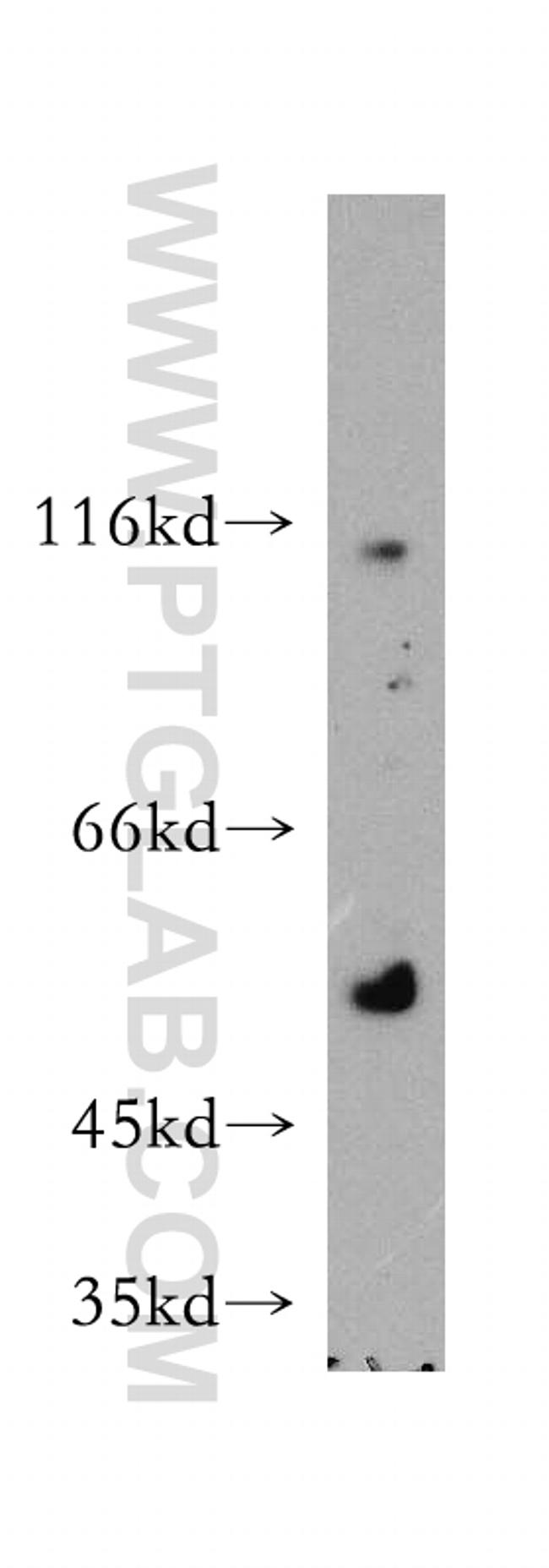 TXNRD1 Antibody in Western Blot (WB)