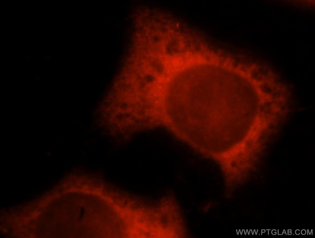 TXNRD1 Antibody in Immunocytochemistry (ICC/IF)