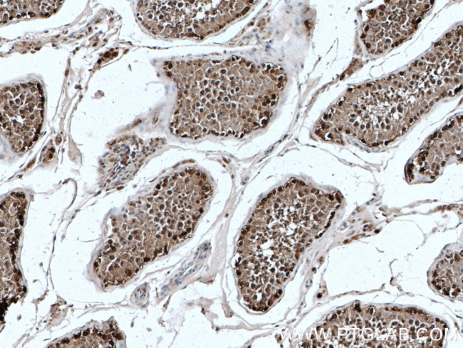 TXNRD1 Antibody in Immunohistochemistry (Paraffin) (IHC (P))