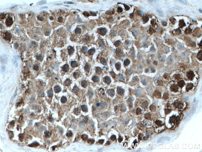 TXNRD1 Antibody in Immunohistochemistry (Paraffin) (IHC (P))