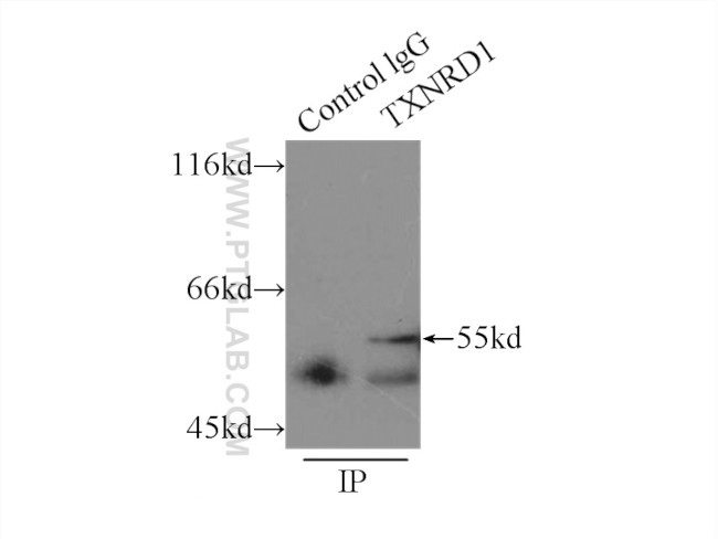 TXNRD1 Antibody in Immunoprecipitation (IP)