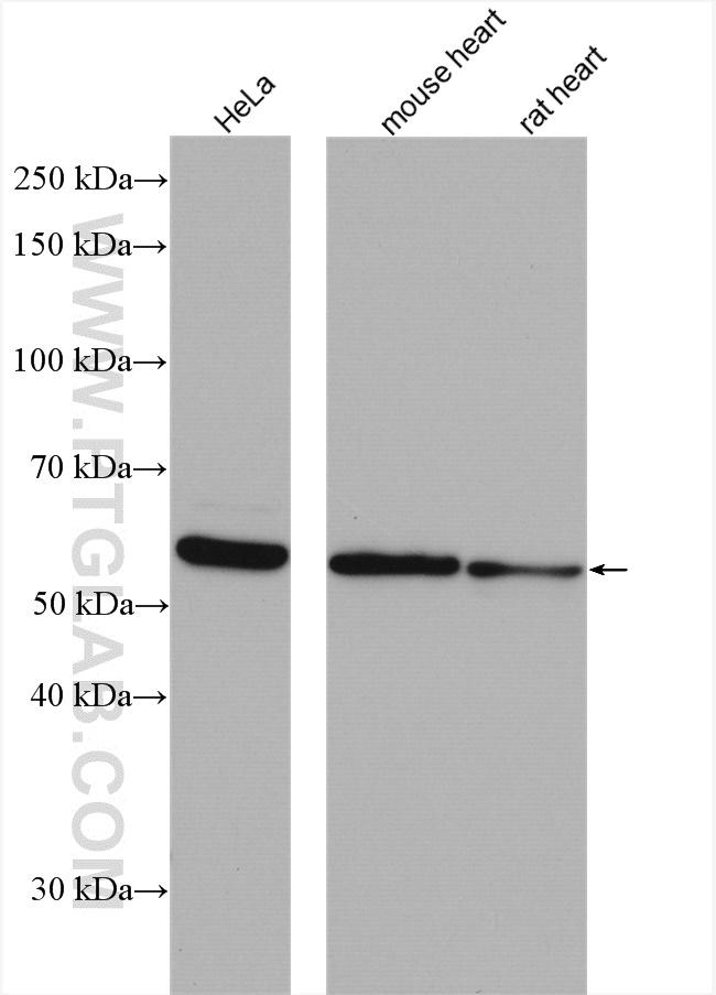 TXNRD1 Antibody in Western Blot (WB)