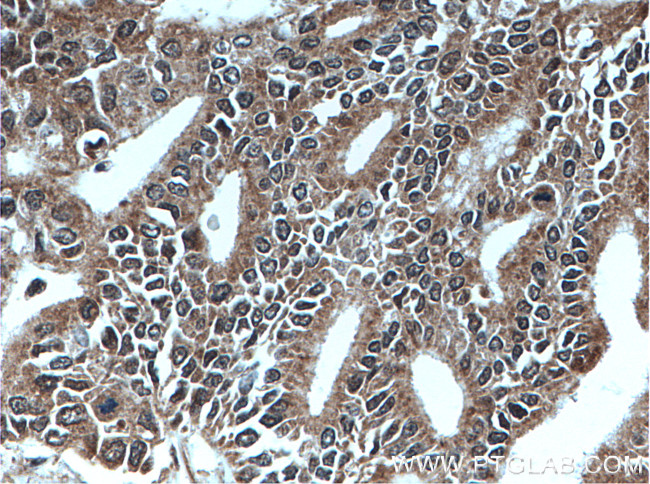 MEST Antibody in Immunohistochemistry (Paraffin) (IHC (P))