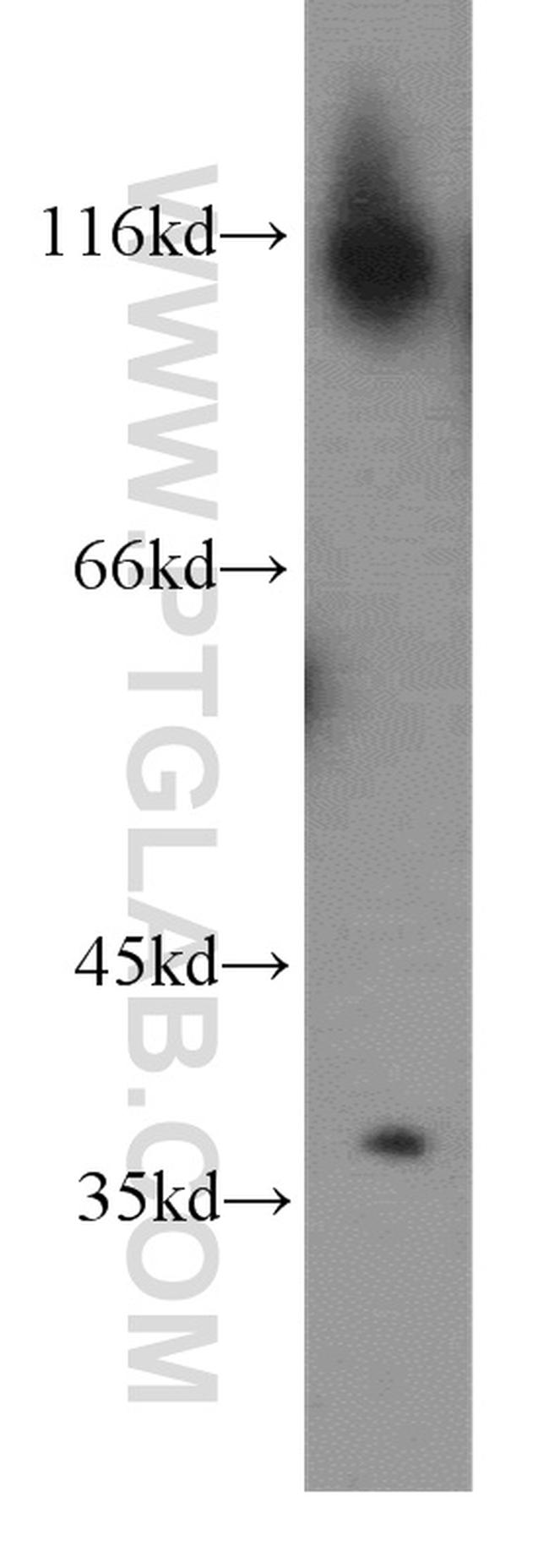 MEST Antibody in Western Blot (WB)