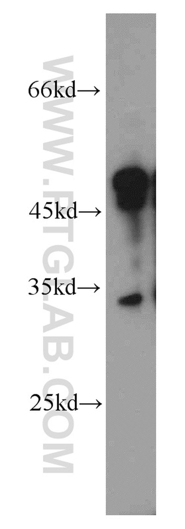 MEST Antibody in Western Blot (WB)