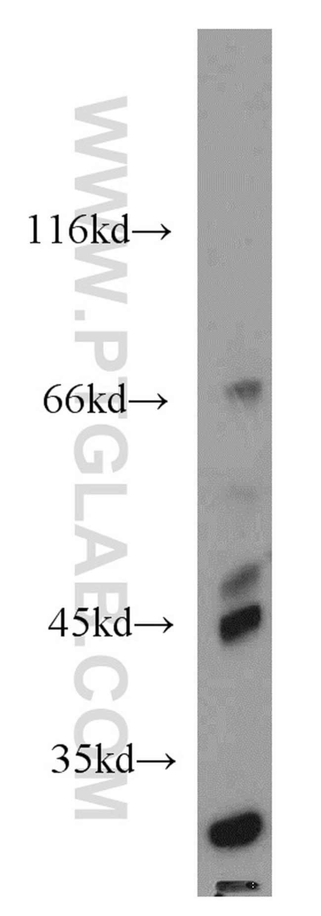 MEST Antibody in Western Blot (WB)