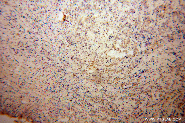 DAZAP1 Antibody in Immunohistochemistry (Paraffin) (IHC (P))