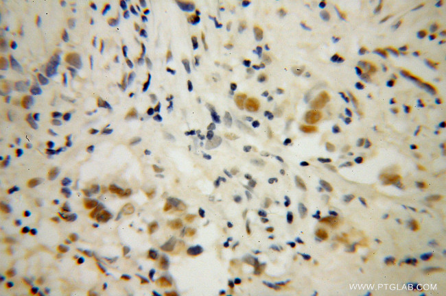 DAZAP1 Antibody in Immunohistochemistry (Paraffin) (IHC (P))