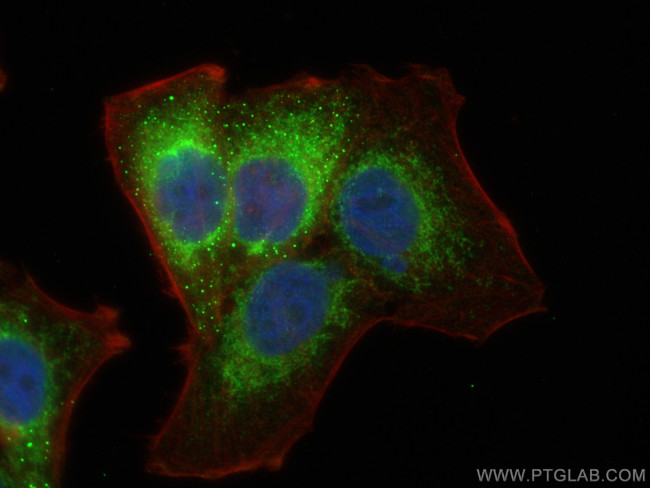 Tim23 Antibody in Immunocytochemistry (ICC/IF)