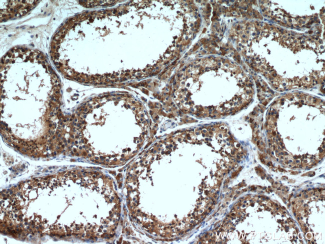 Tim23 Antibody in Immunohistochemistry (Paraffin) (IHC (P))