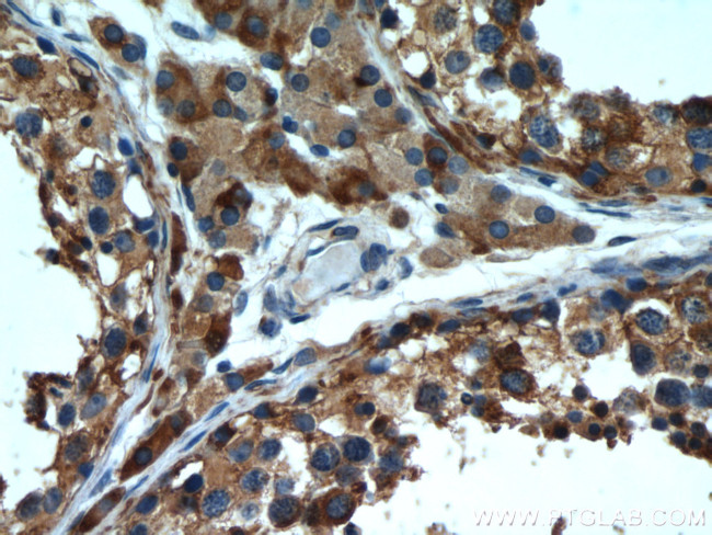 Tim23 Antibody in Immunohistochemistry (Paraffin) (IHC (P))