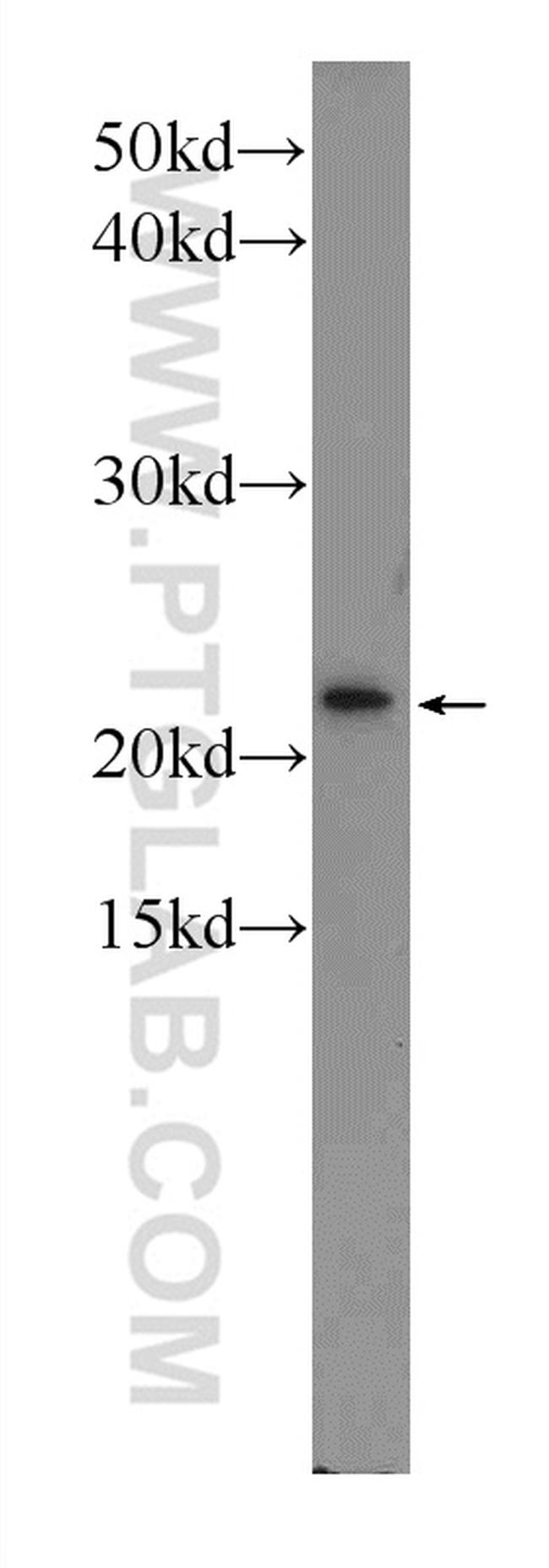 Tim23 Antibody in Western Blot (WB)