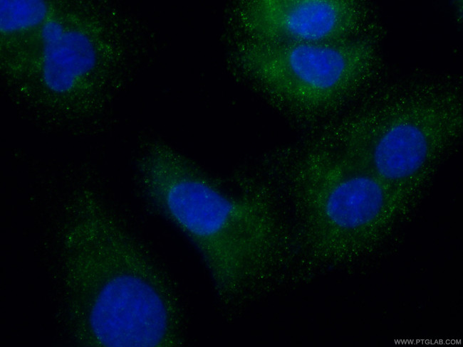 TESC Antibody in Immunocytochemistry (ICC/IF)