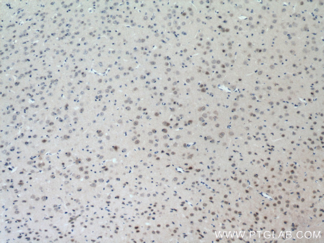 TESC Antibody in Immunohistochemistry (Paraffin) (IHC (P))